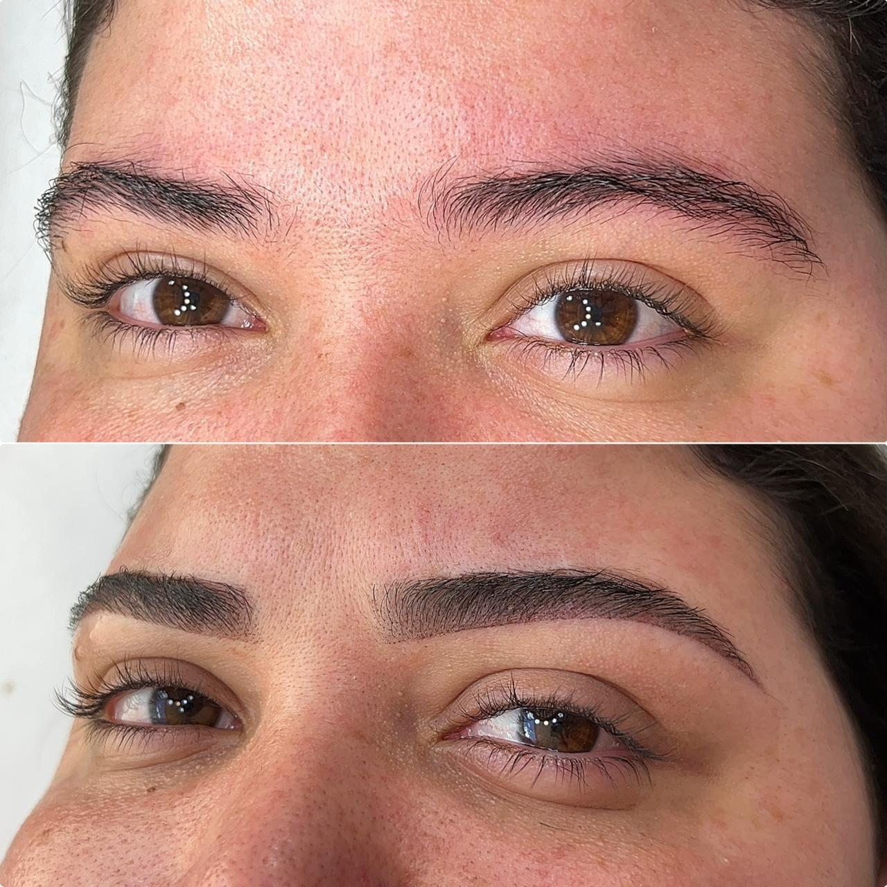 Antes e Depois Sobrancelha Real